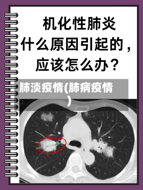 肺淡疫情(肺病疫情)